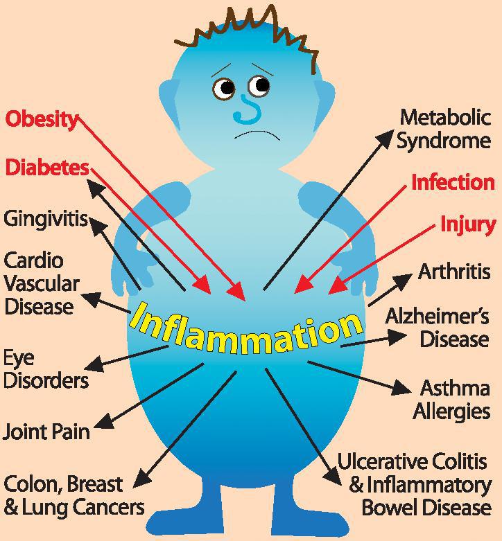 dangers-of-inflammation-your-health-is-at-risk-hometown-family